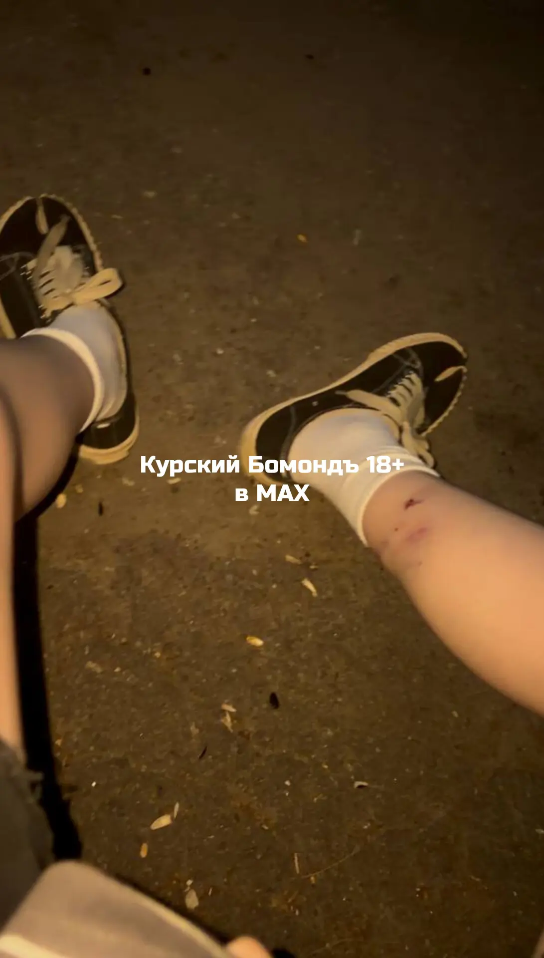 #нампишут
Вчера около 21:30 на нас (две девочки) напали собаки. Все это произошло на соседней улице,