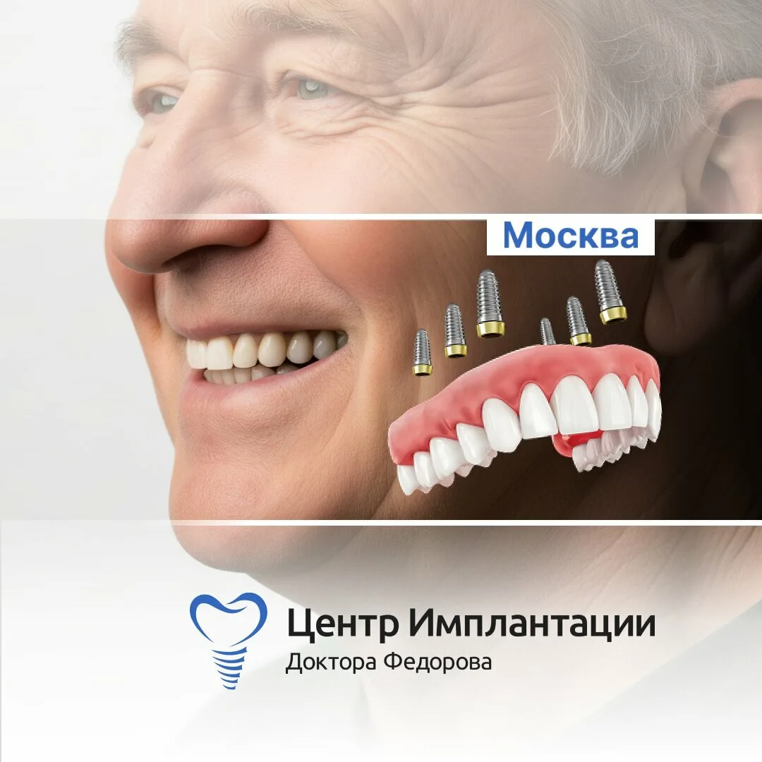 Все зубы на 6-ти имплантах с выгодой 70.000 ₽ в Москве!

Проведём имплантацию всей челюсти на 6-ти о