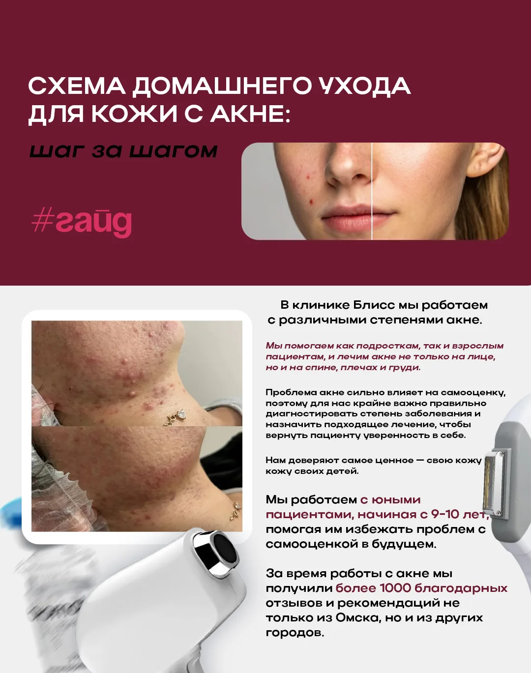 📍Гайд по уходу за кожей с акне