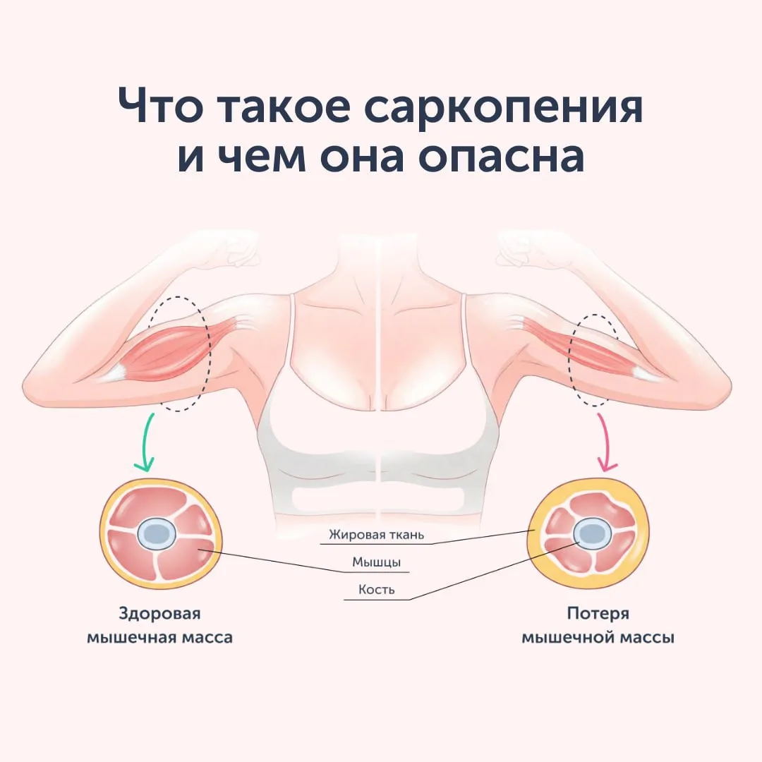 Саркопения — главный враг молодости

Вес остаётся прежним. Питаетесь правильно. А тело становится ры