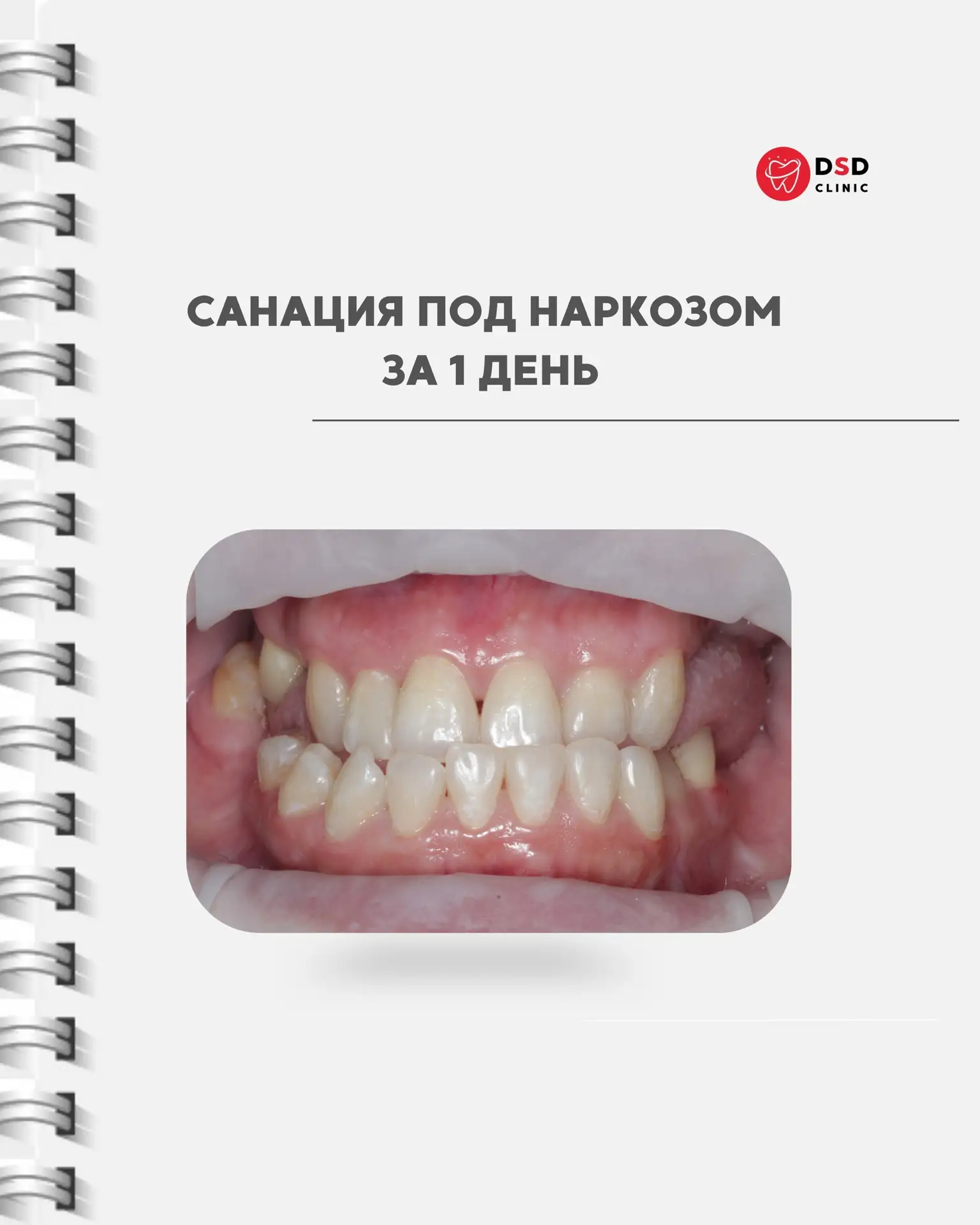 За каждым сложным клиническим случаем стоит большая командная работа, точная диагностика и детально 
