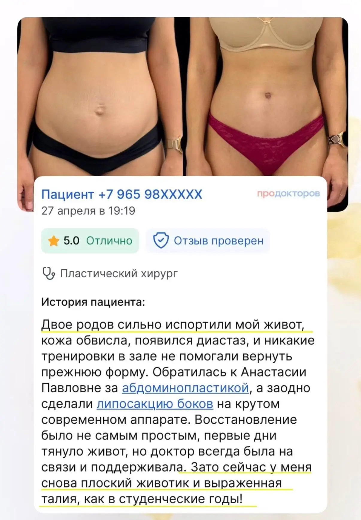 Точеный живот после родов 🔥🔥🔥

Коррекция выпирающего живота и лишней кожи в этой зоне после берем