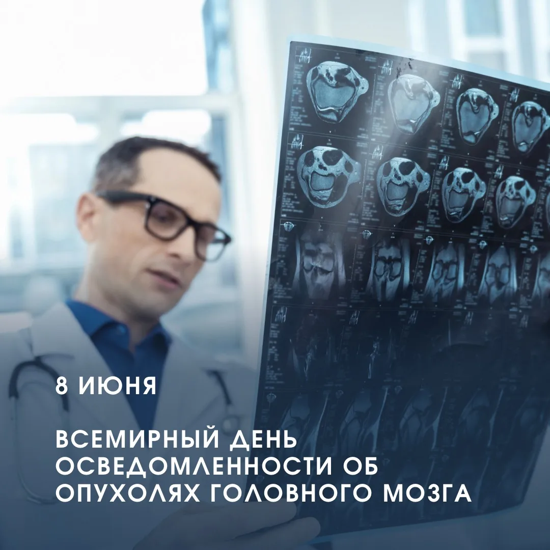 🧠 8 июня — Всемирный день осведомленности об опухолях головного мозга.

Опухоли головного мозга ост