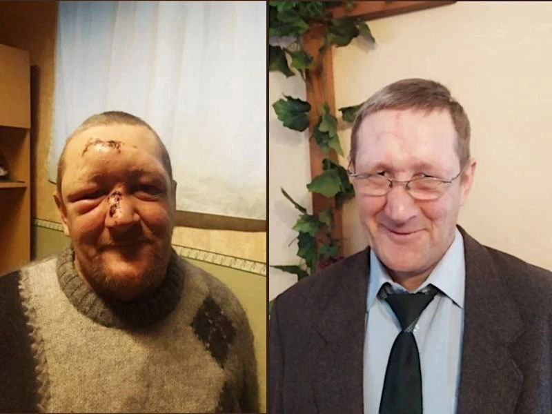 Бросить пить алкоголь — задача непростая, но вполне осуществимая. Вот несколько шагов, которые могут