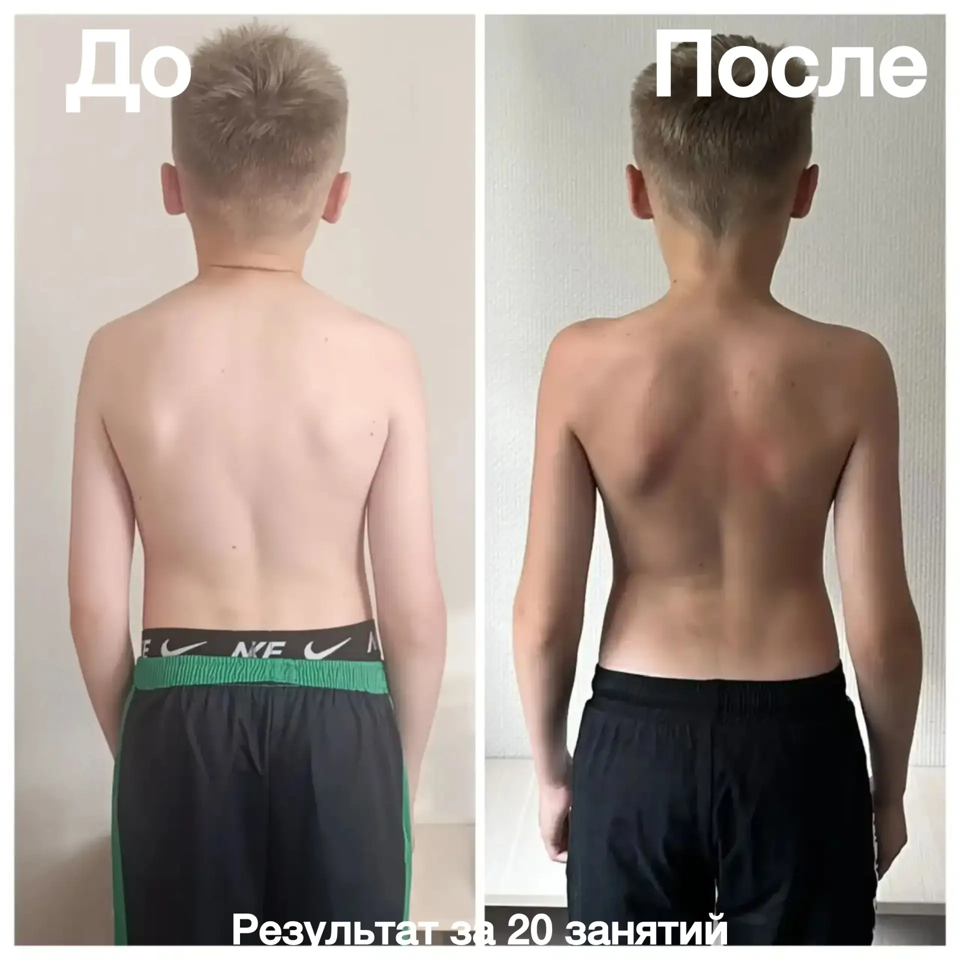 Представляем Вашему вниманию результат ребенка за 10 занятий 🔥🔥🔥

✅Круглые плечи опустились ,
✅По