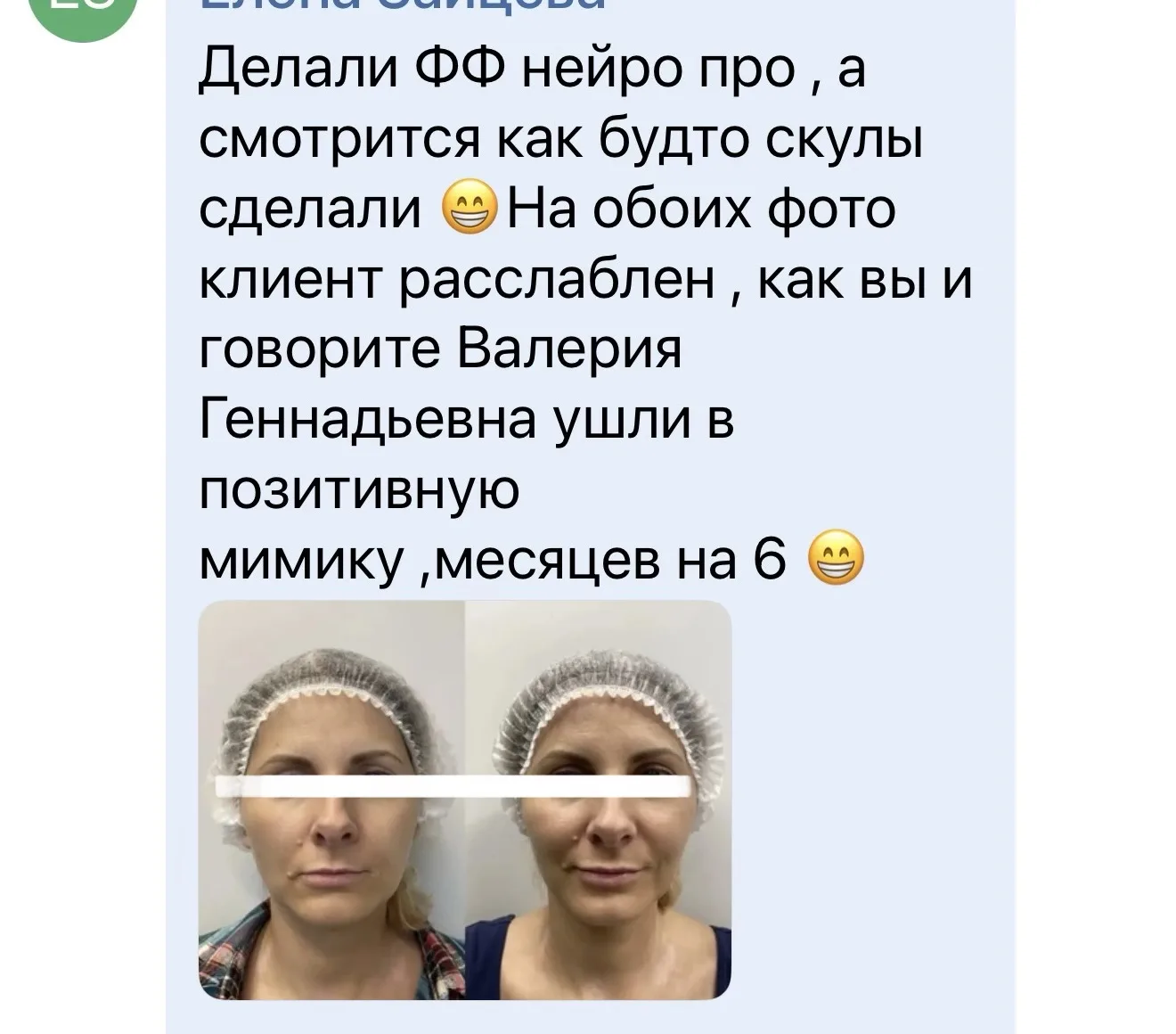 Самая большая ошибка в ботулинотерапии сегодня — смотреть на пациента и видеть мимические морщины.

