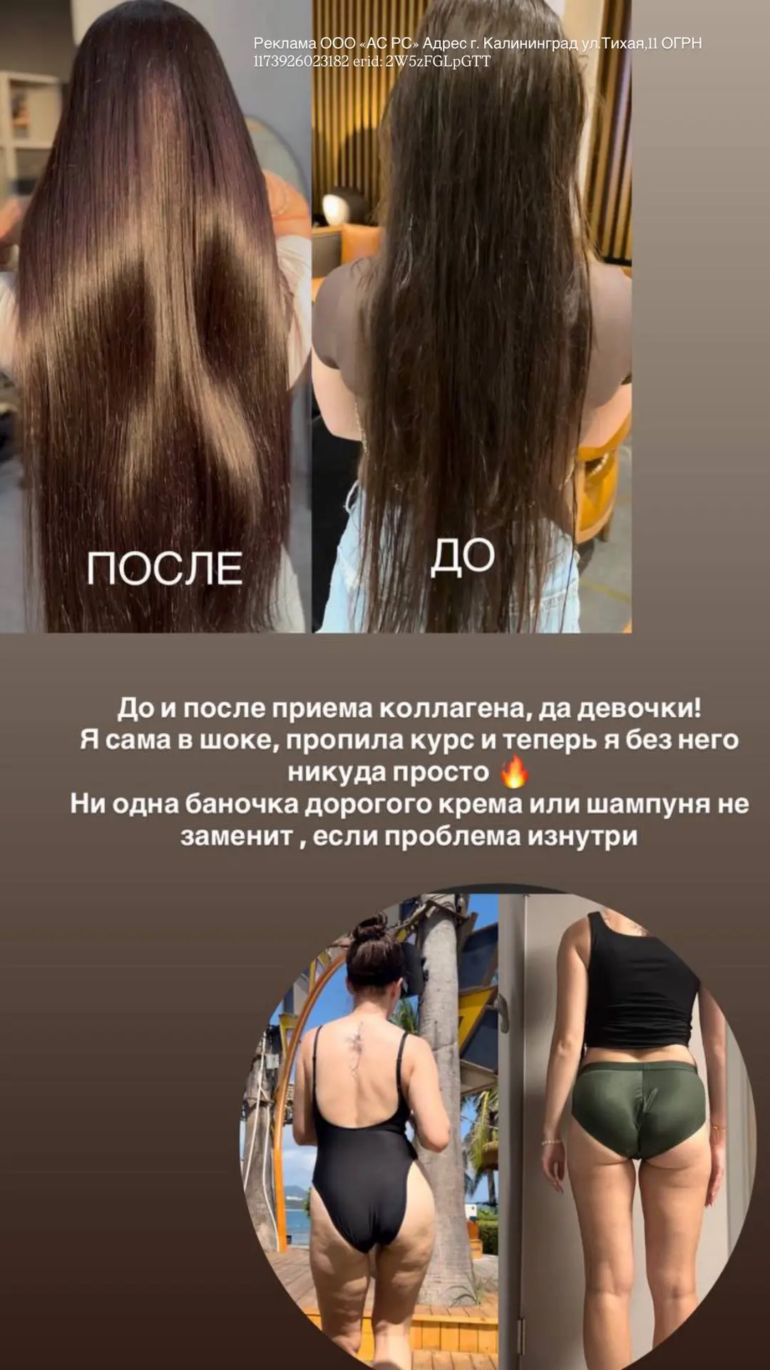 Допила очередную баночку своего коллагена 

Результат прикрепила ЗА ВСЕ ВРЕМЯ ПРИЕМА (больше полугод