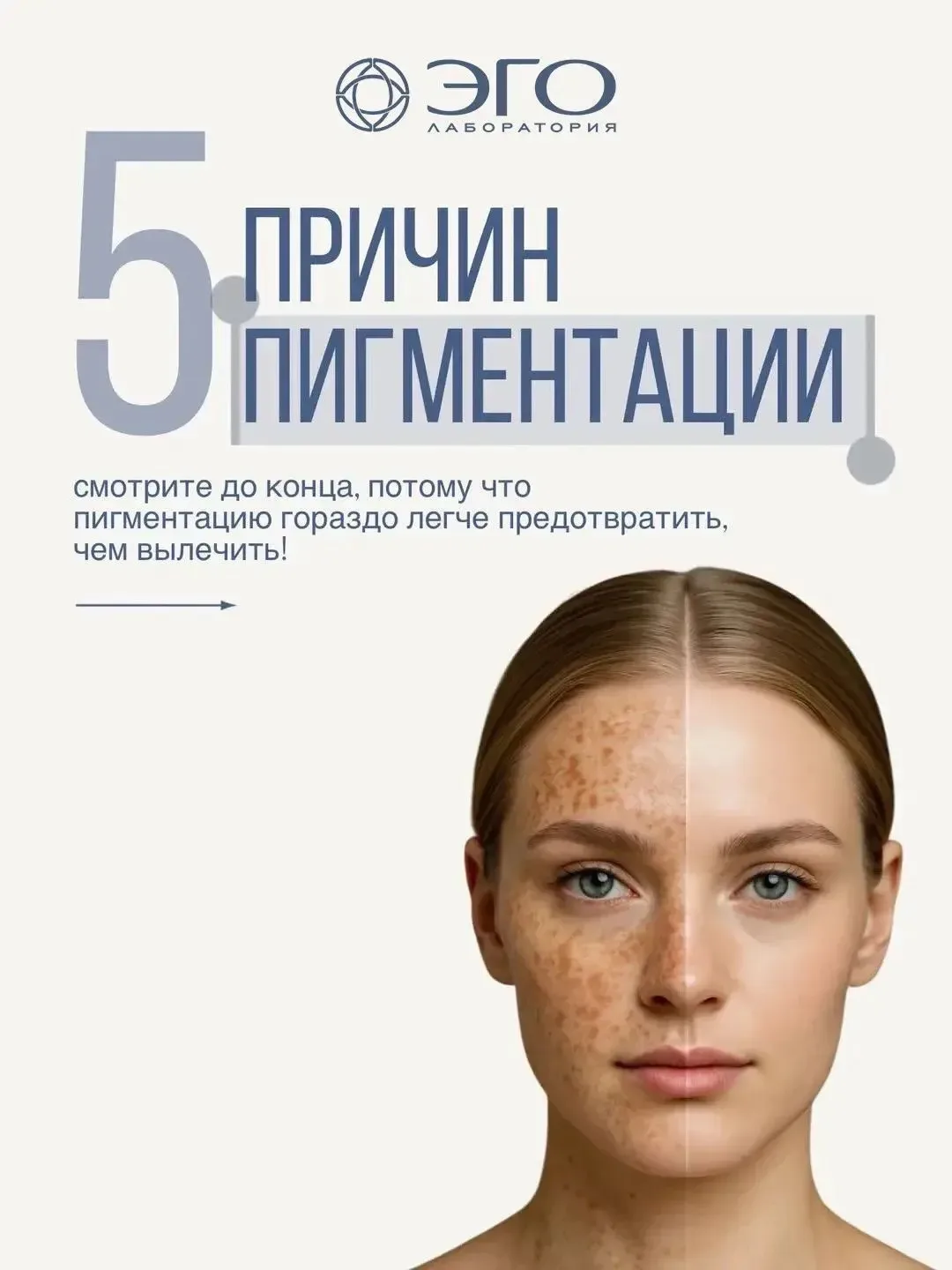 🔥Пигментация не появляется «просто так» — у нее всегда есть причина, и чем раньше ее найти, тем быс