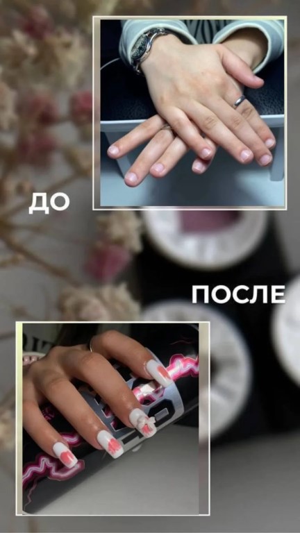 Фото