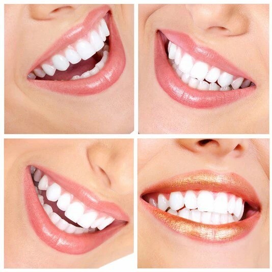 Фото