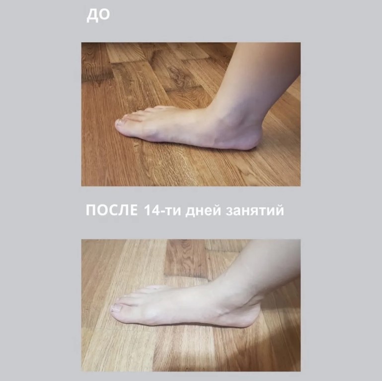 Фото