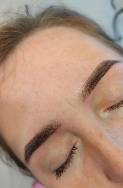 Фото