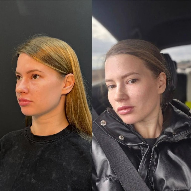 Фото