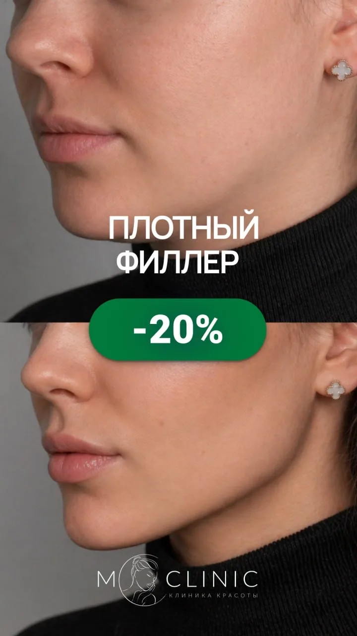 🔥 МАЙСКИЙ ПРАЙМ-ЛИСТ: 

Идеальный момент освежить внешность и решить давние эстетические задачи без