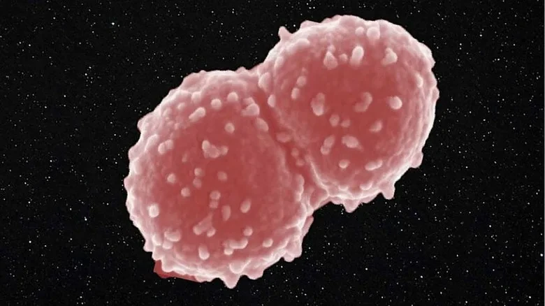 Бактерия Deinococcus radiodurans выдерживает дозу радиации в 5000 раз выше смертельной для человека
