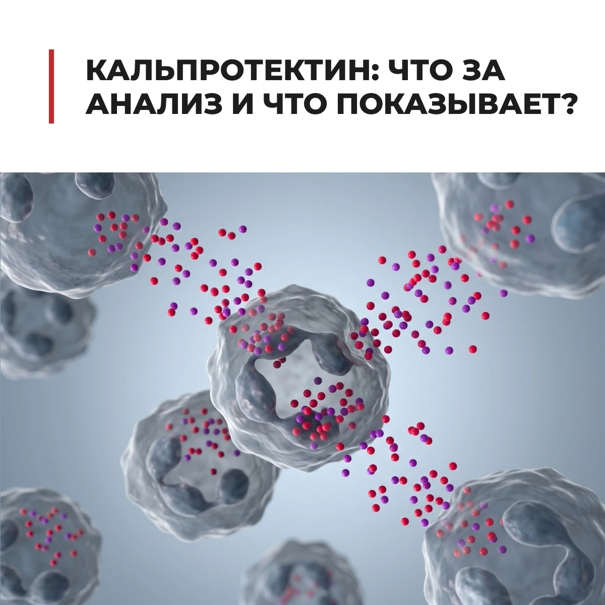 Боль в животе, длительная диарея, кровь в стуле, потеря веса — при таких симптомах врач...
