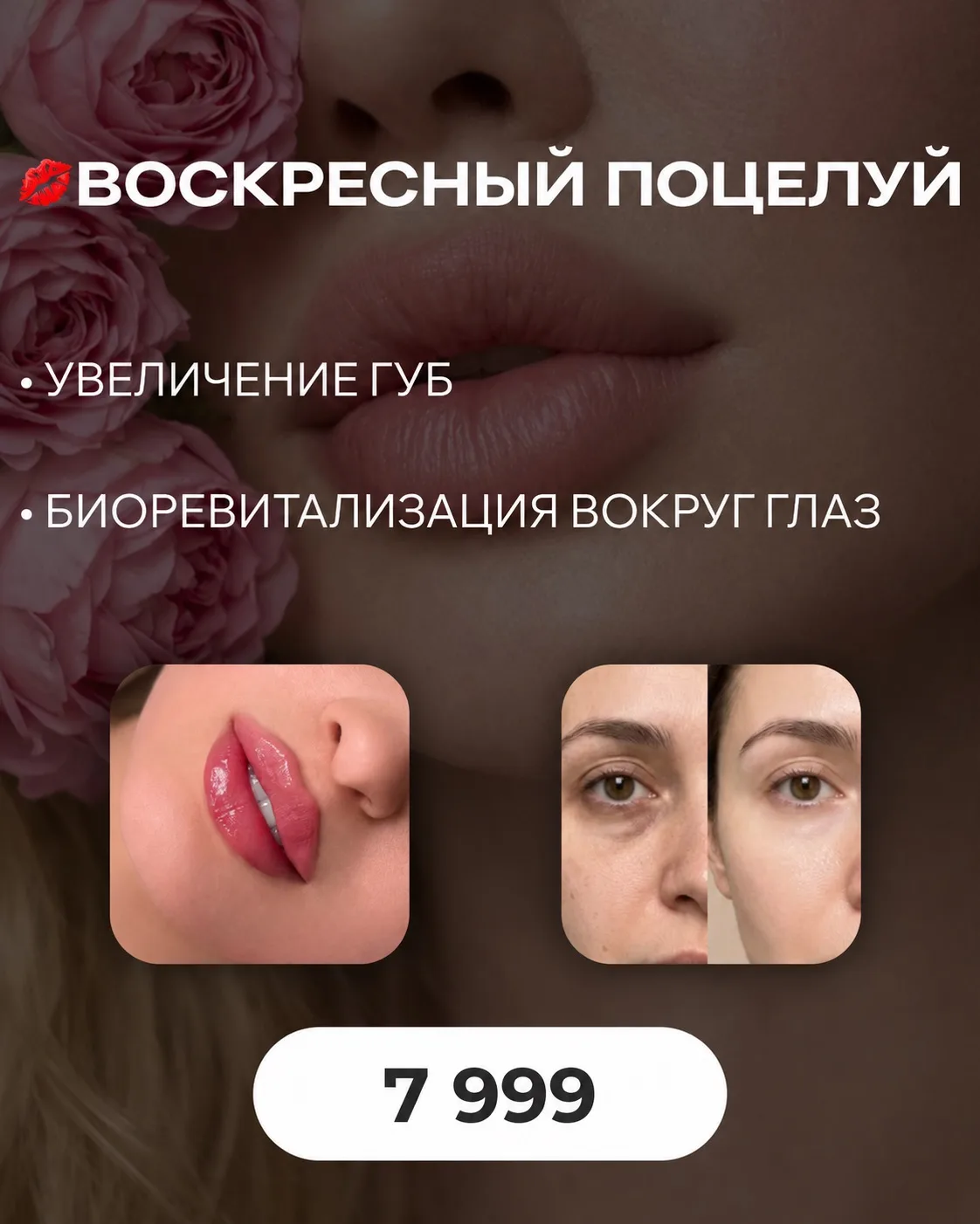 💋 ВОСКРЕСНЫЙ ПОЦЕЛУЙ