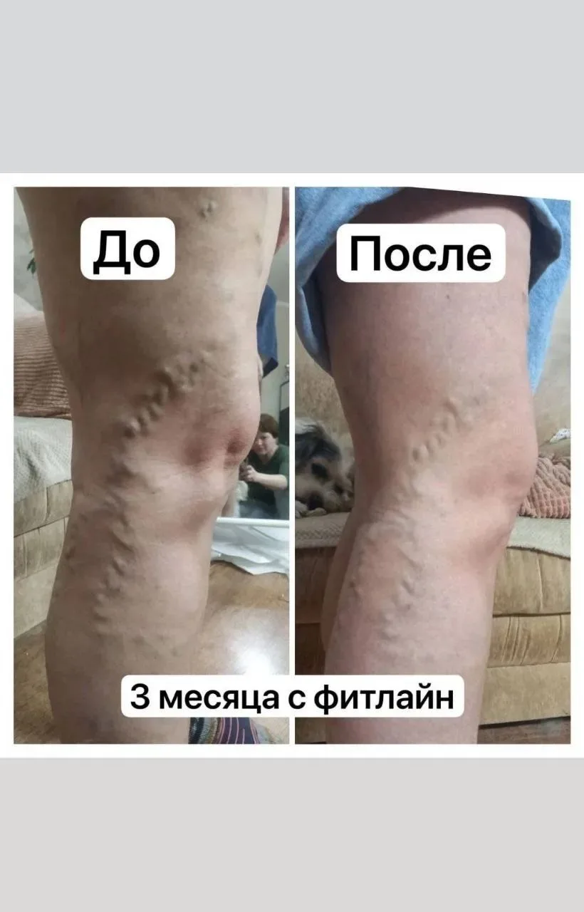 Реальные отзывы про продукцию FitLine