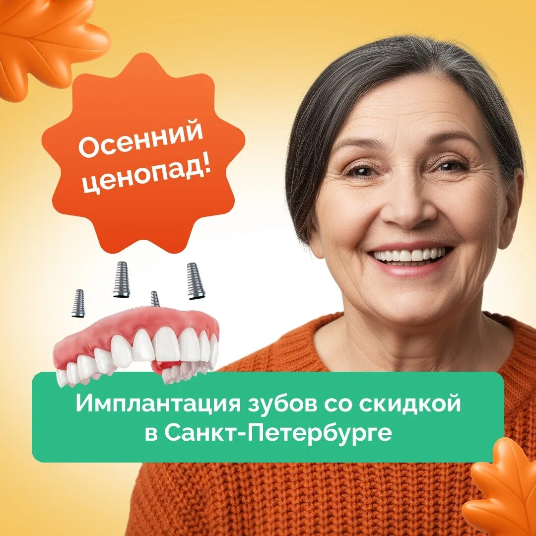 Челюсть на 4-х имплантах за 1 день в Санкт-Петербурге!