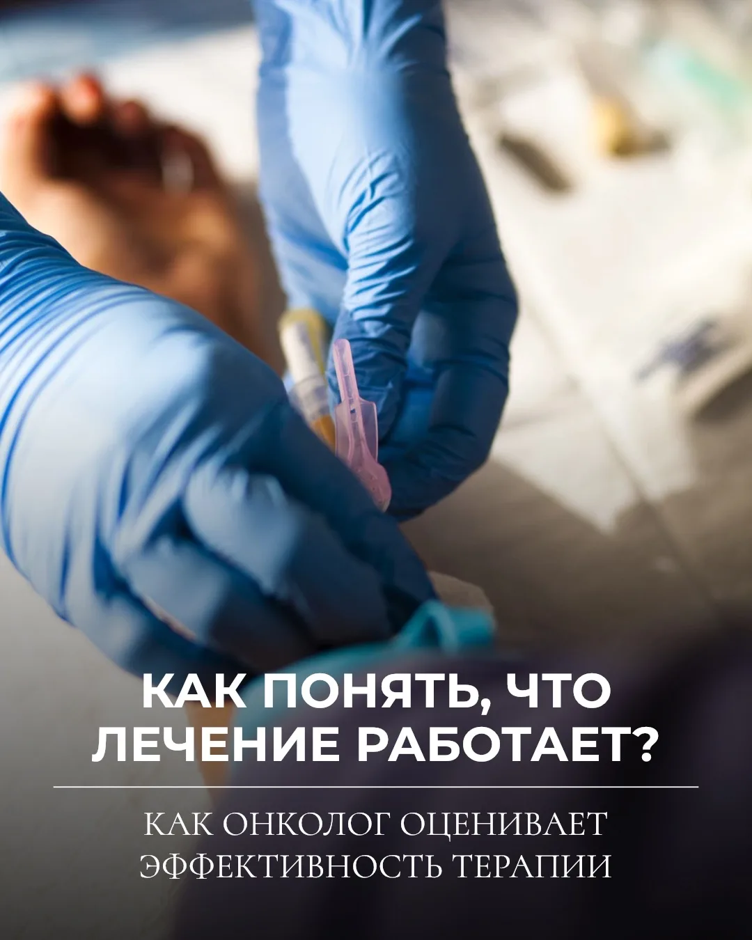 💉 Как понять, что противоопухолевое лечение работает?