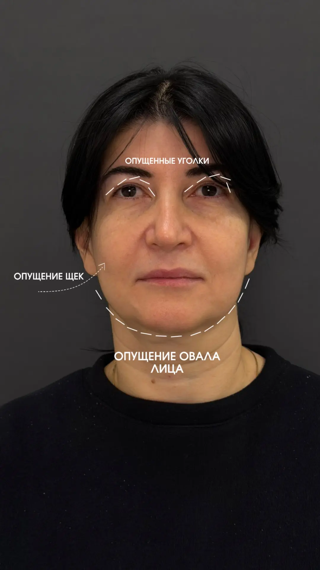 «Эту операцию мне подарили сыновья»