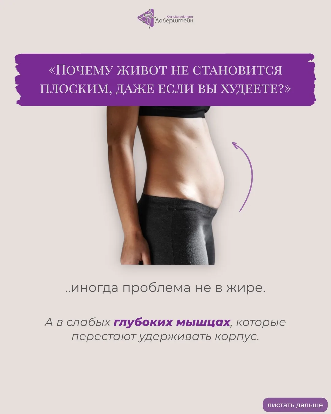Иногда пациенты приходят с запросом «убрать живот» или «подтянуть тело», но в процессе разговора мы 