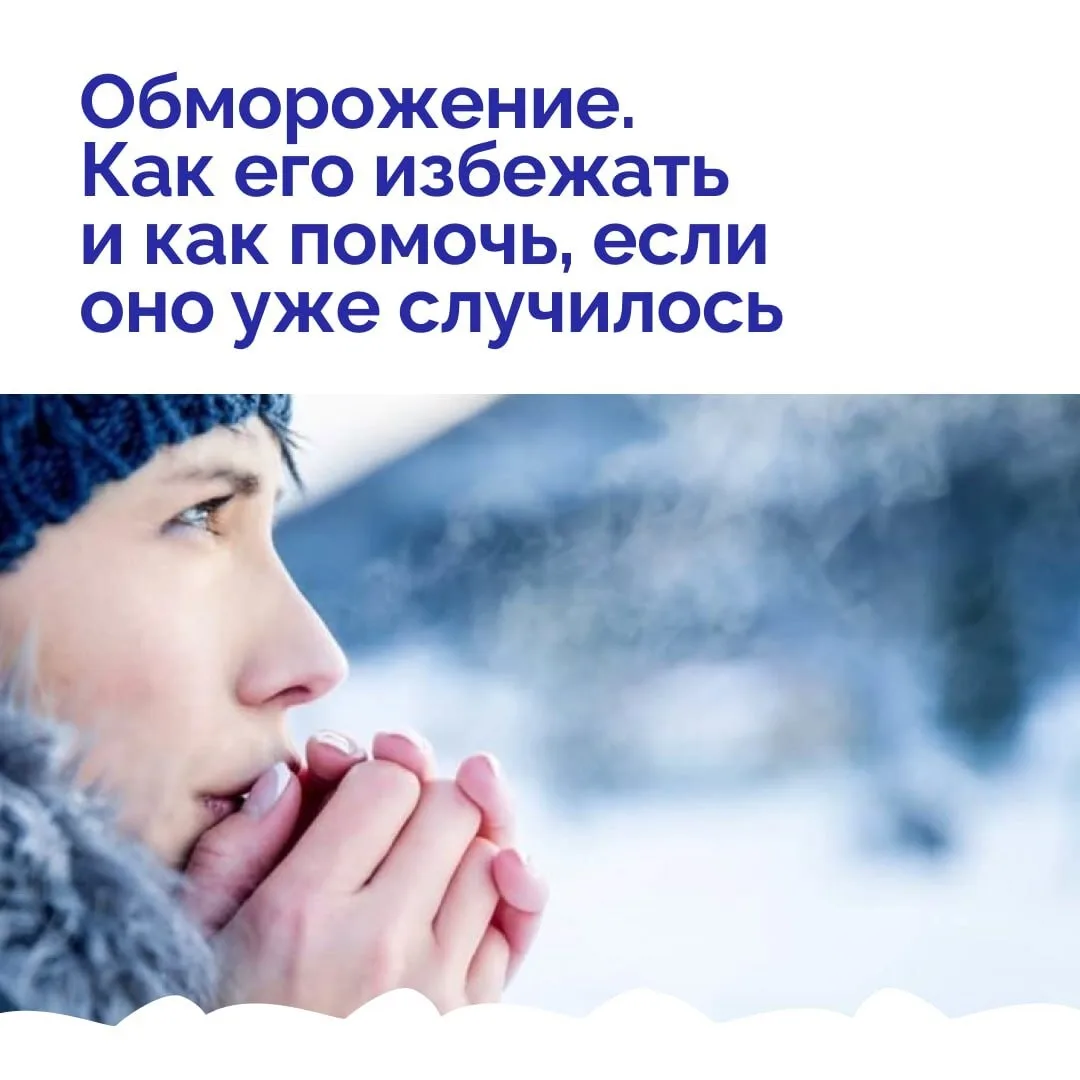 Зимой риск обморожений особенно высок — даже при небольшом минусе за окном холод, ветер и влажность 