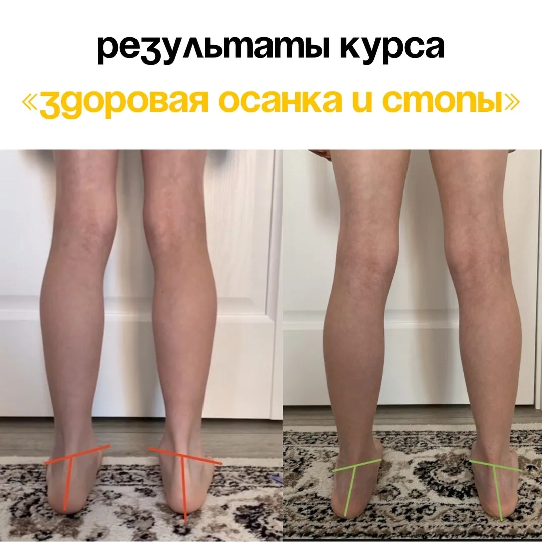 «Мы же занимаемся спортом, у нас не может быть плохой осанки»  С таким заблуждением сталкиваются мно