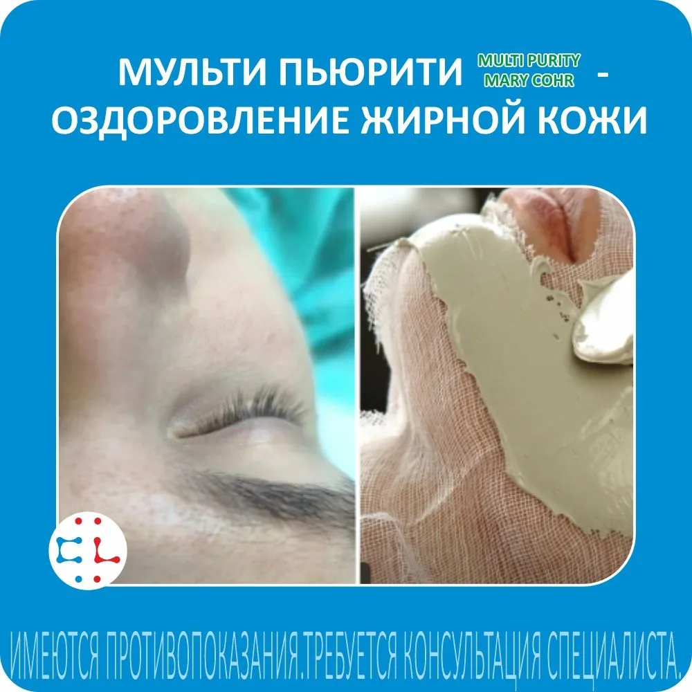 Проблема кожи с жирным блеском в течение всех сезонов очень актуальна для наших пациентов.