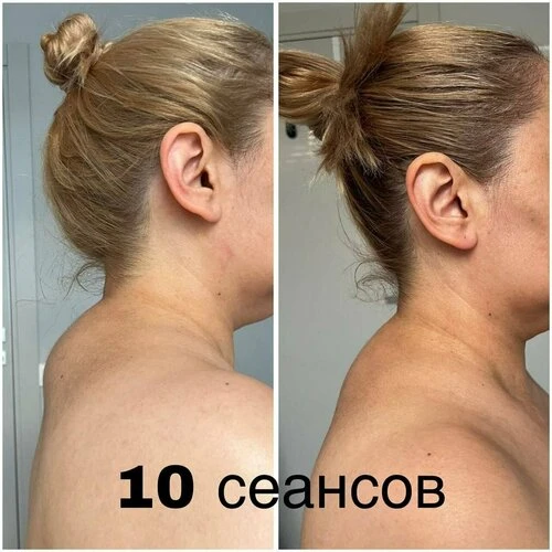 Болит спина? Не можешь сбросить вес? Решу это без переплат!