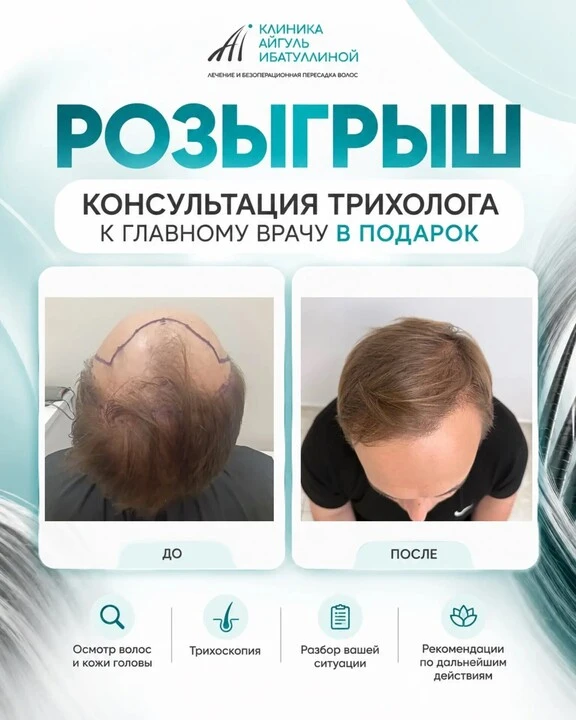 🎁 УФА! РАЗЫГРЫВАЕМ КОНСУЛЬТАЦИЮ ВРАЧА-ТРИХОЛОГА