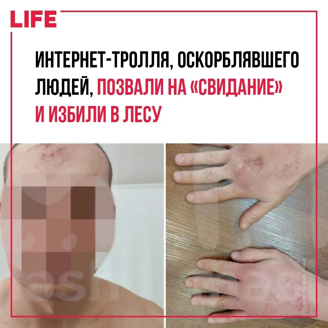Строителя Александра избили в Бутовском лесу после конфликтов в комментариях Telegram. ...