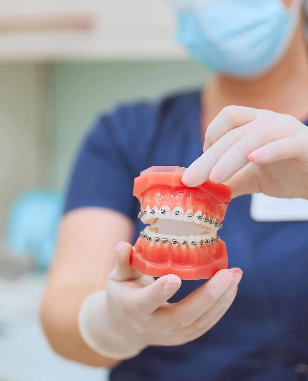 🦷Во время ношения брекетов следует уделять особое внимание качеству гигиены зубов. При неправильной