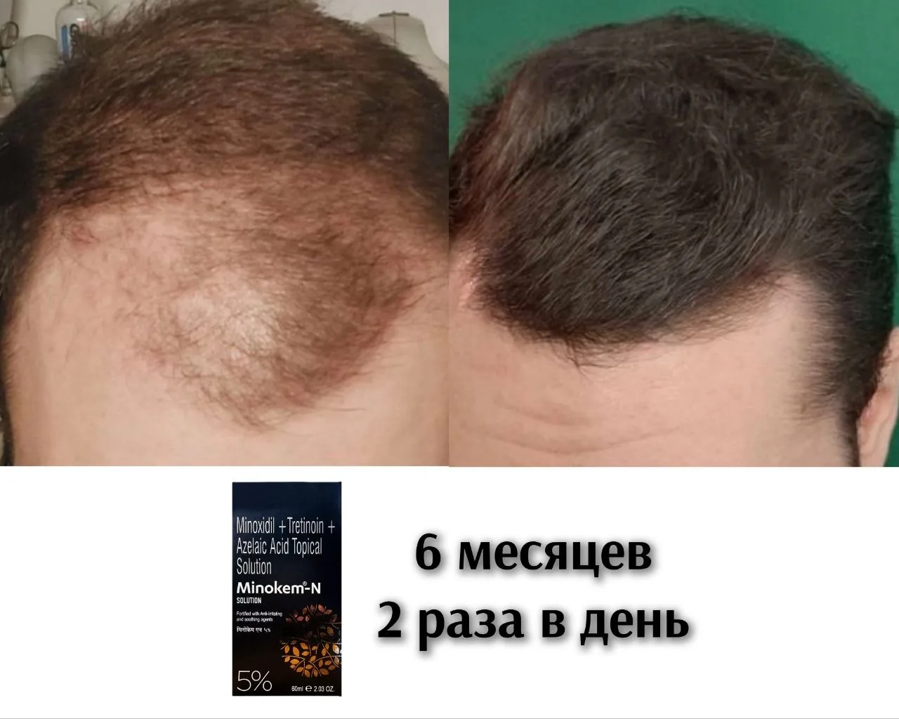 Здесь фото пациента сделаны самостоятельно