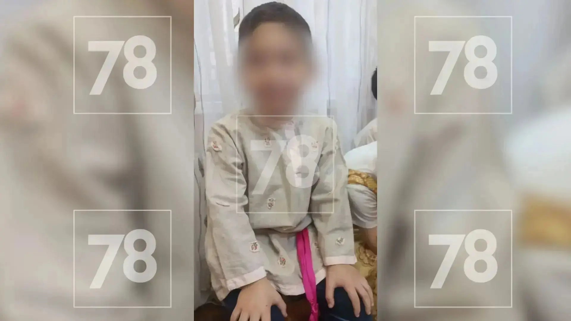 Трепанацию черепа сделали мальчику, голову которого зажало воротами на Коломенской