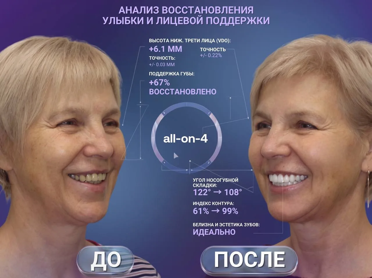 👍Как и обещали, показываем преображение Светланы Николаевны — супруги Сергея Васильевича, чью истор