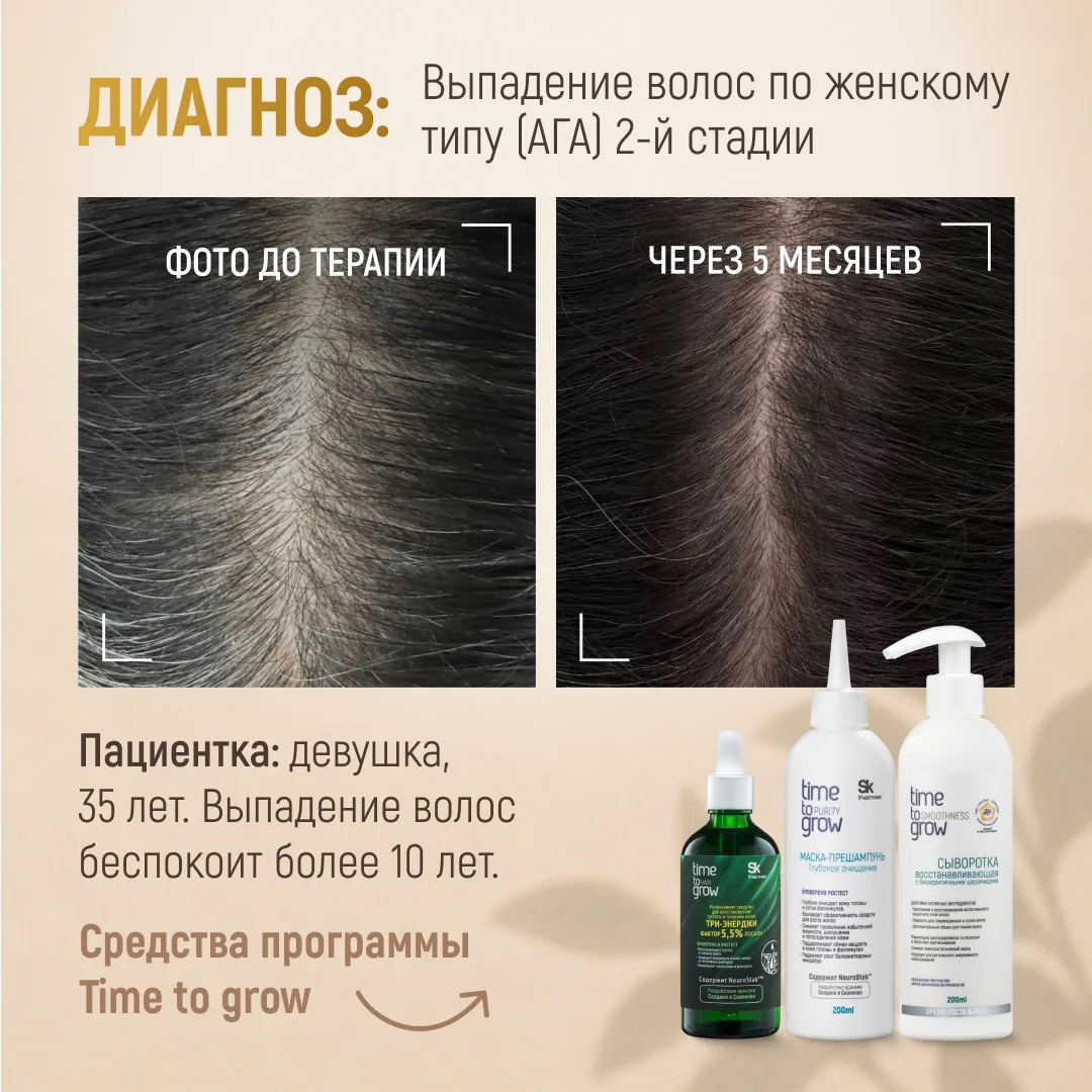 Клинический случай из практики к.м.н., врача-дерматолога, трихолога, терапевта, хирурга, транспланто