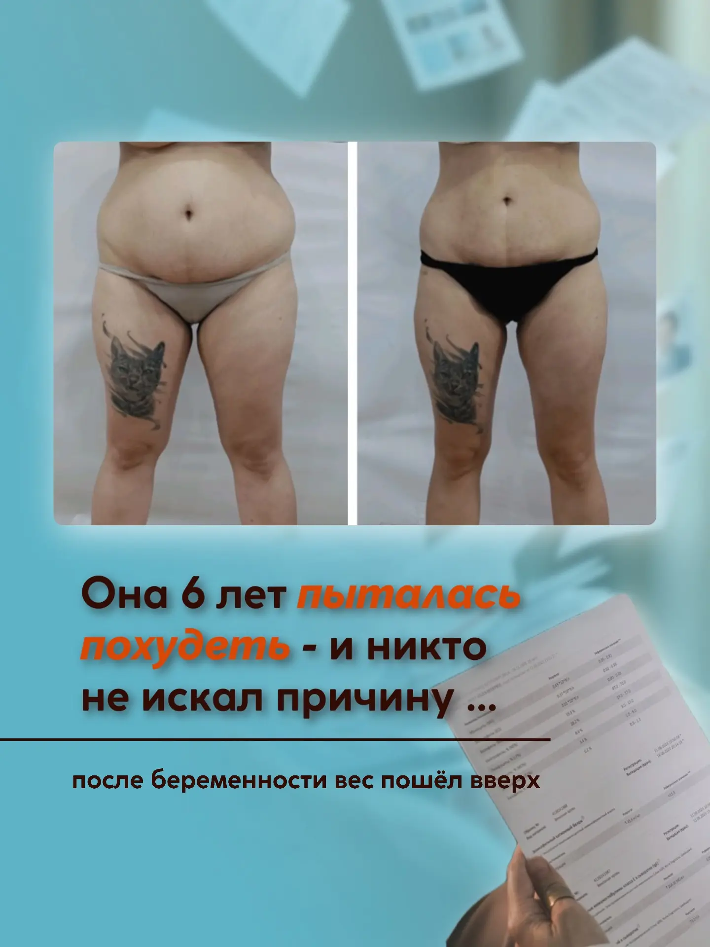 «Я уже 6 лет не могу сбросить вес» - с таким запросом пришла девушка ✍🏻