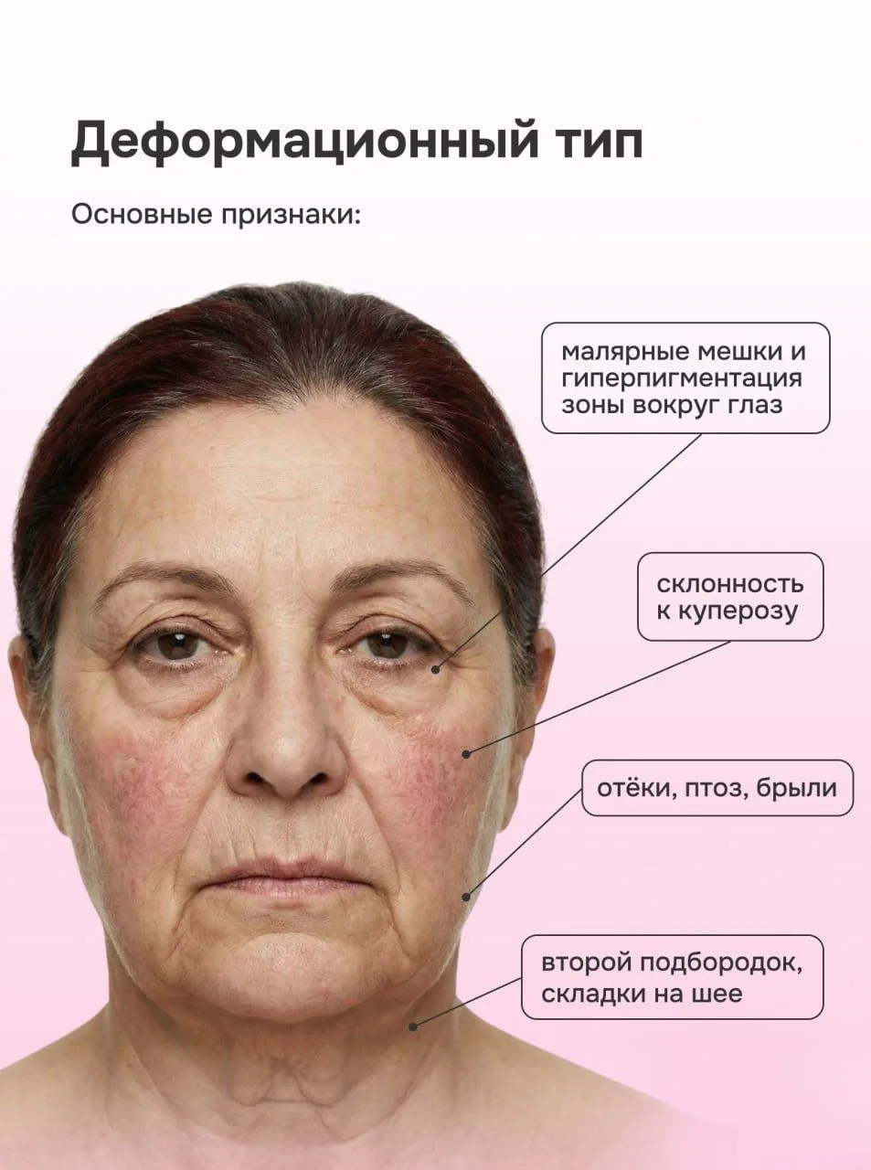 Как подобрать anti-age уход по типу старения?  Остановить время мы не можем, зато вполне способны до