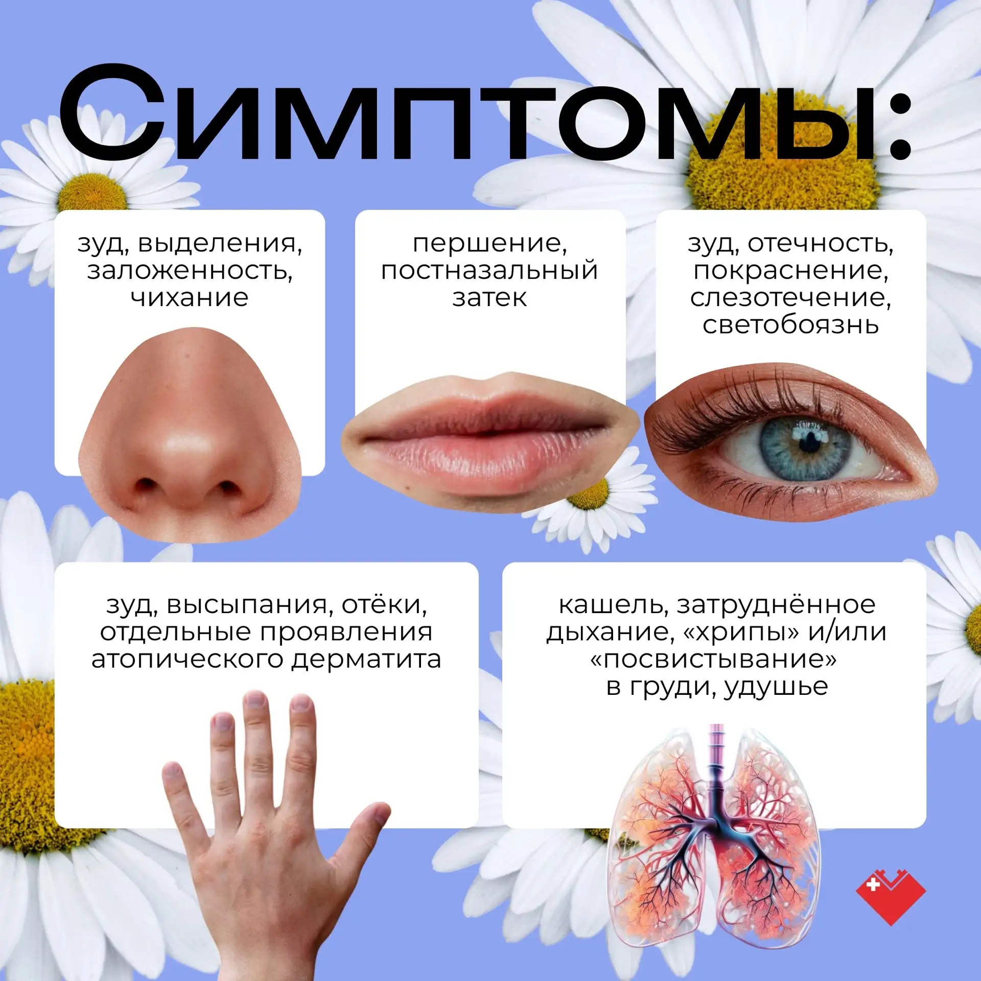 🤧Аллергия — это аномальная реакция иммунной системы на внешние раздражители.