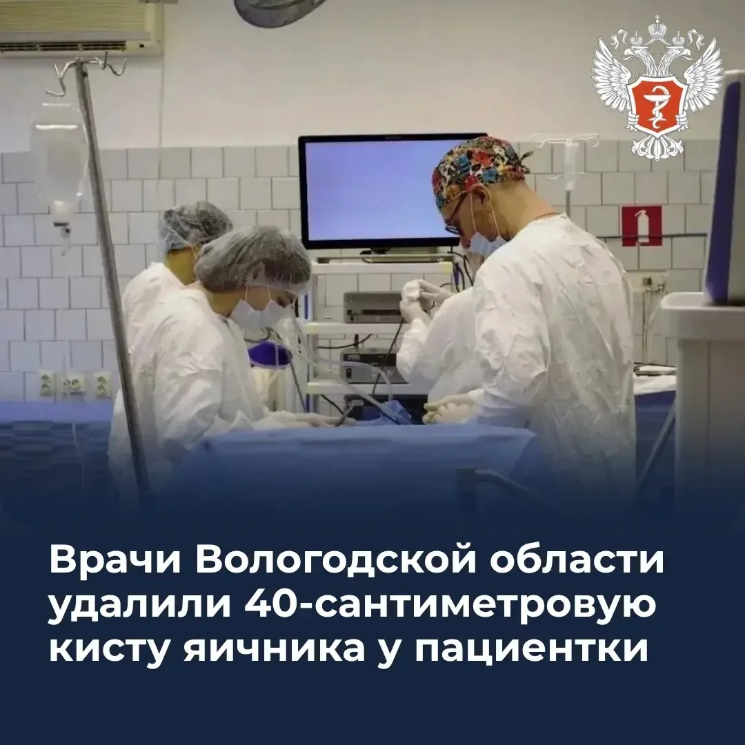 🏥 Врачи Вологодской области удалили 40-сантиметровую кисту яичника у пациентки 
 
В гинекологическо