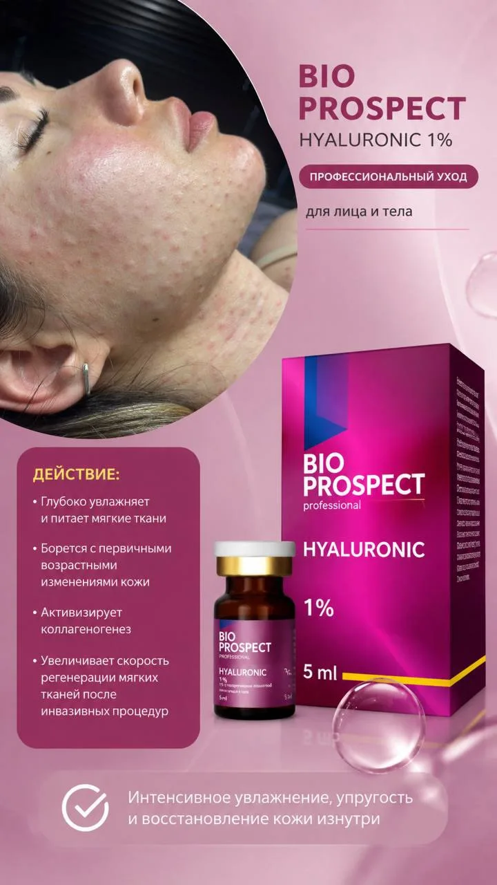 ✨ ИЩУ 5 ДЕВУШЕК НА БИОРЕВИТАЛИЗАЦИЮ BIOPROSPECT ✨
