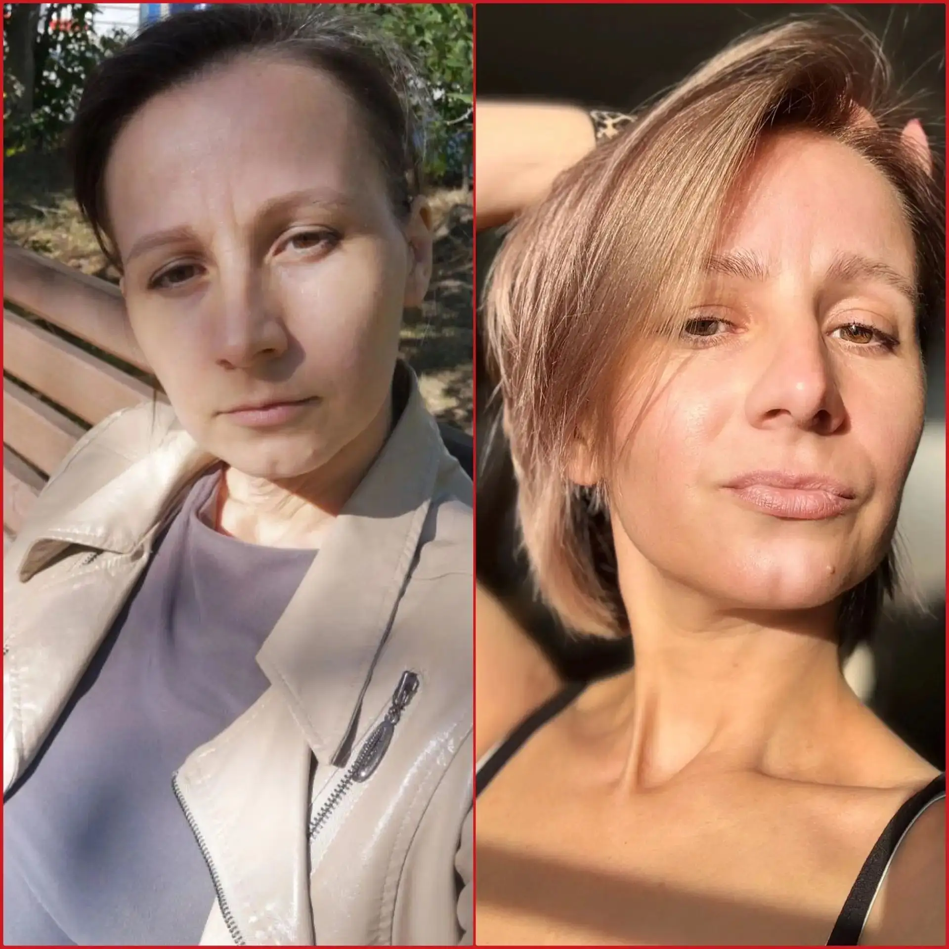 Тоже результат на коллагене ну и в принципе пользуюсь всем продуктом ❤️ в этом месяце 4...