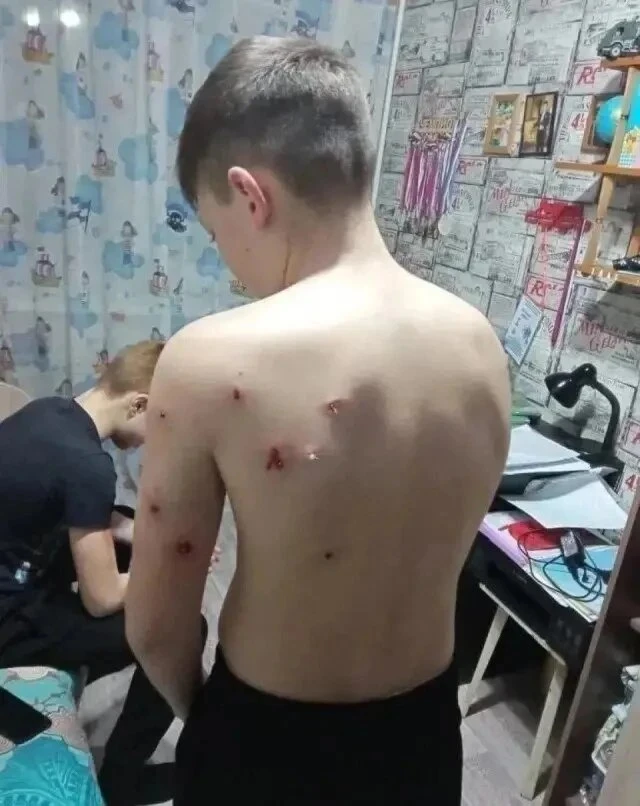🔞На Урале пенсионер открыл огонь по подросткам, которые годами его травили  Пожилой мужчина выстрели