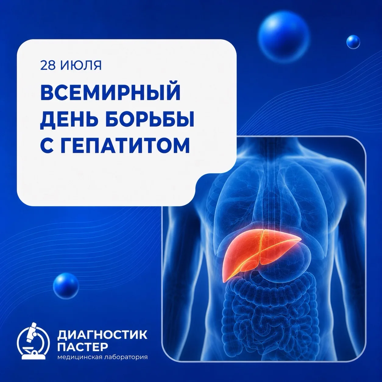 28 июля — Всемирный день борьбы с гепатитом