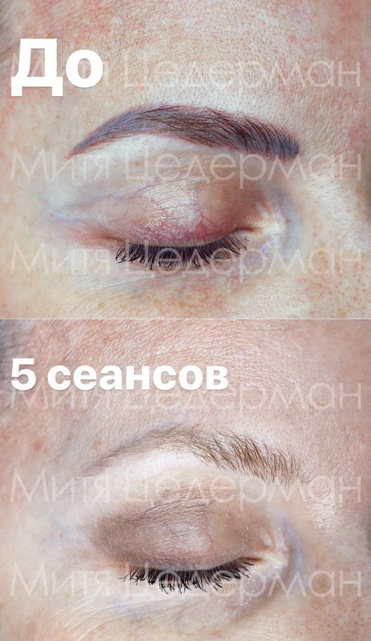 ПЕРЕКРЫТИЯ ВСЕГДА БУДЕТ ВИДНО 🙌🏽