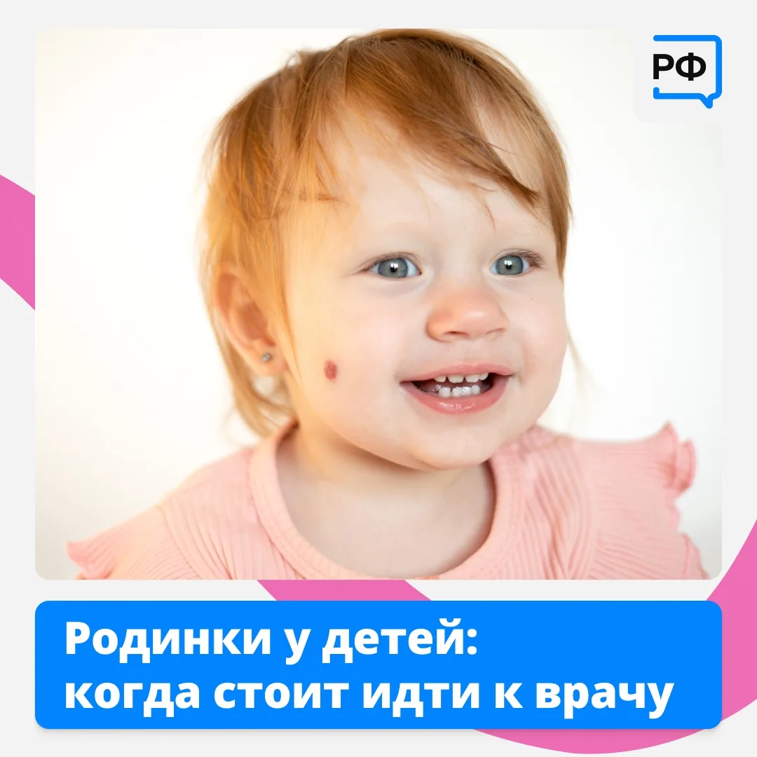 Если у ребёнка родинки быстро растут или меняют цвет, это повод обратиться к врачу.