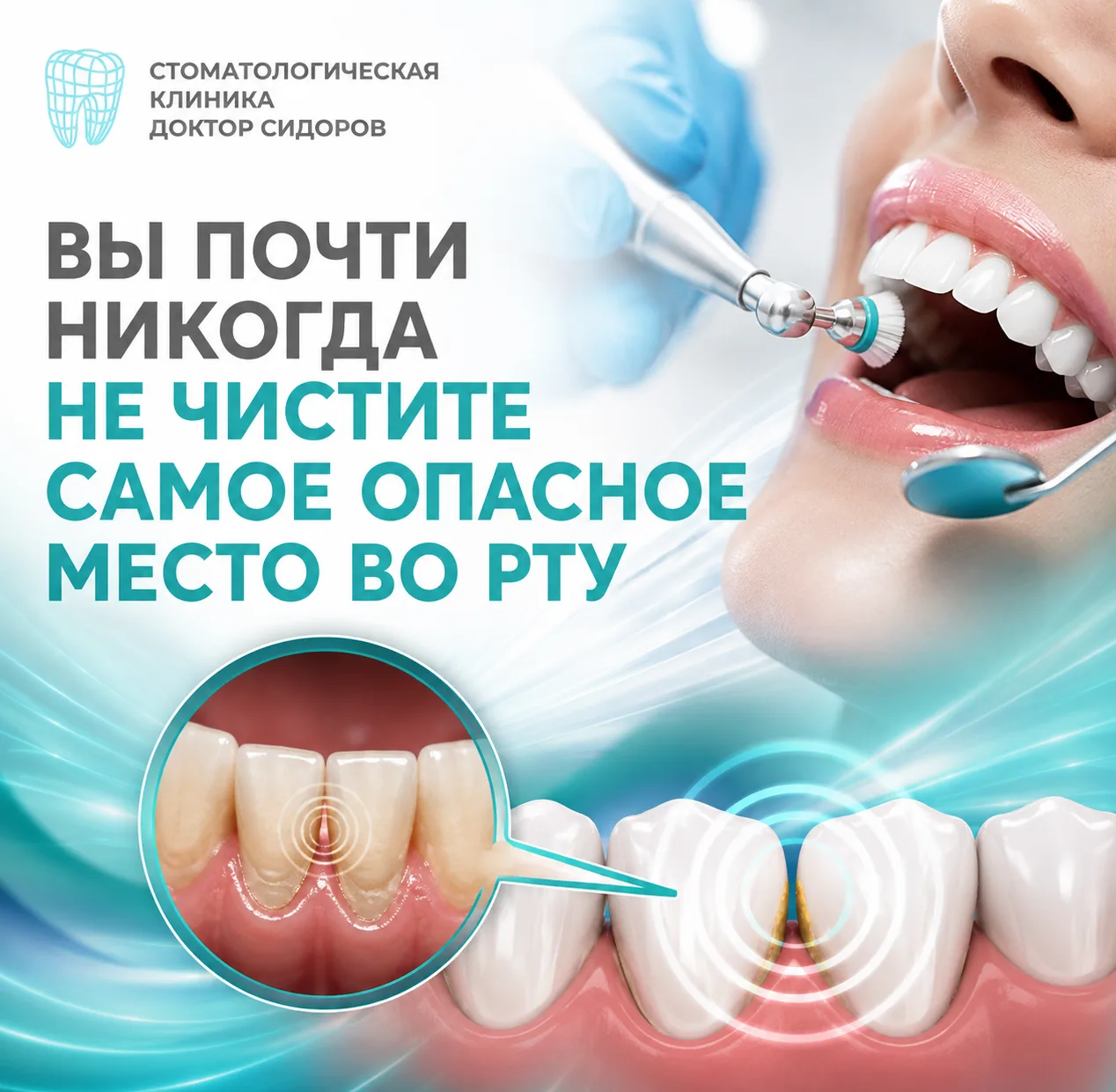 ⚠ Самое опасное место во рту вы почти никогда не чистите