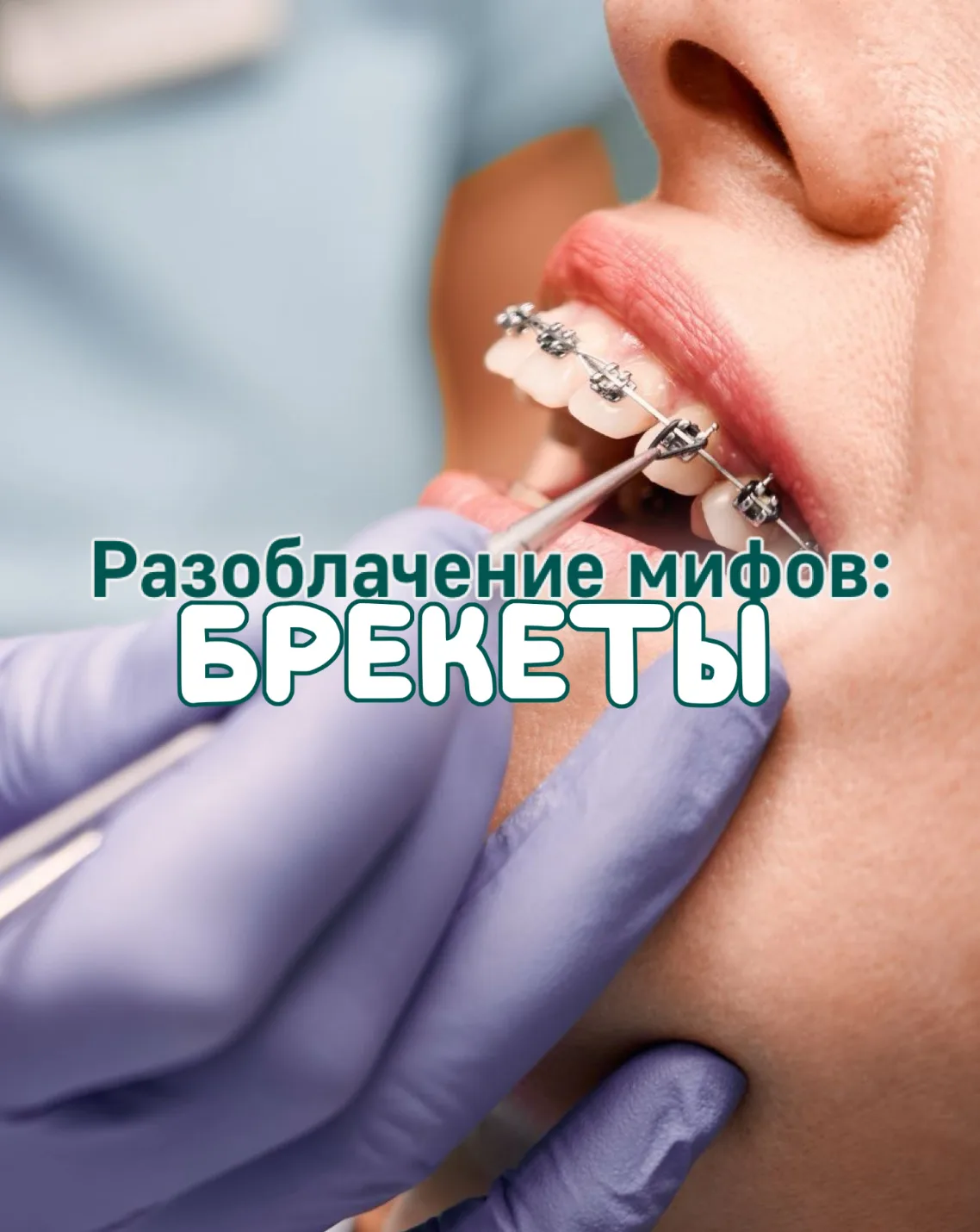 Многие до сих пор откладывают визит к ортодонту из-за «страшилок», которые не имеют нич...