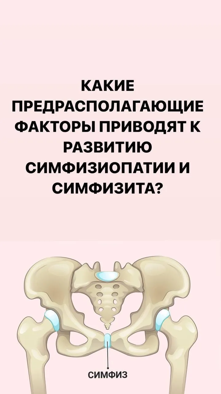 🔴Симфизит